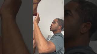 Look At This Transformation One Of The Craziest Arm Lift Transformations