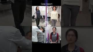 Generalized Dystonia 25Y.o Female Korea