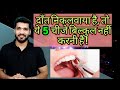 दाँत निकलवाने के बाद ये बिलकुल न करे ! Don't do these 5 things after tooth removal