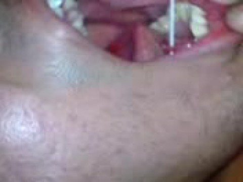 Tags:piercing frenulum tongue lengua arete perforacion frenillo danytal