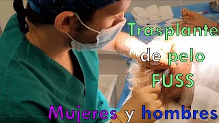 TRASPLANTE de PELO TIRA-FUSS en directo (Mujeres y hombres)