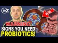 Probiotics For Gut Health   Warning Signs That You Need Probiotics