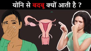 योनि से बदबू आने के कारण और उपाय | Vaginal Odour | Vaginal Smell |  Dr Sushila S