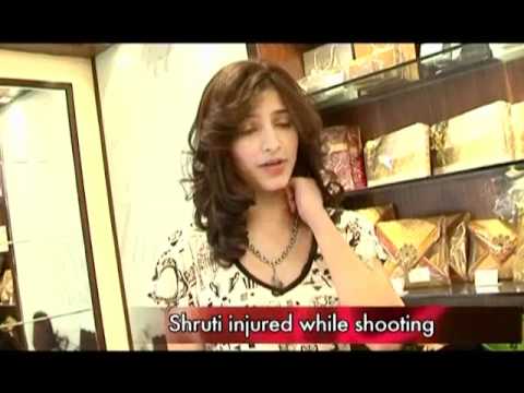 Shruti injures herself on the sets OF 7am Arivu
