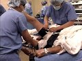 ACL Surgery Dr. Allan Mishra Emedx.com