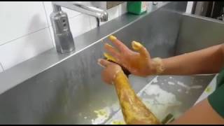 Cerrahi el yıkama tekniği