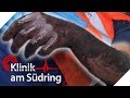 Arm ist schwarz! Wie konnte das passieren? | Klinik am Südring | SAT.1