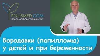 Удаление папиллом радиоволнами отзывы
