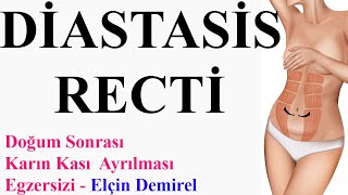 Doğum Sonrası Diastasis Recti (Karın kası ayrılması) Egzersizi