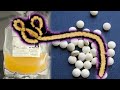 Ebola treatments: pills and plasma transfusions the answer to fighting Ebola?