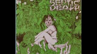 Watch Septic Death Gore Story video