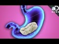 Download What Really Happens When You Swallow Gum? What Really Happens When You Swallow Gum?