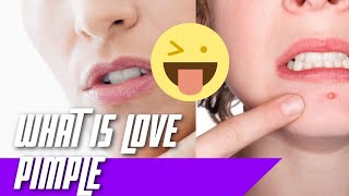 Love Pimple Meaning - What Is A Love Pimple