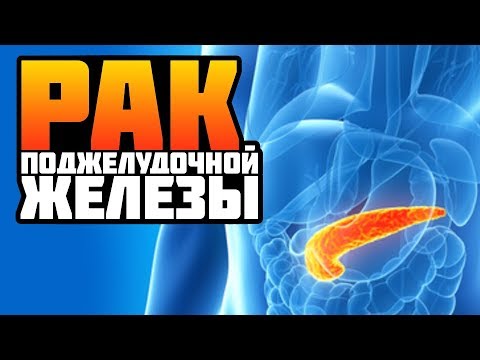 Профилактика рака поджелудочной железы Профилактика рака поджелудочной железы