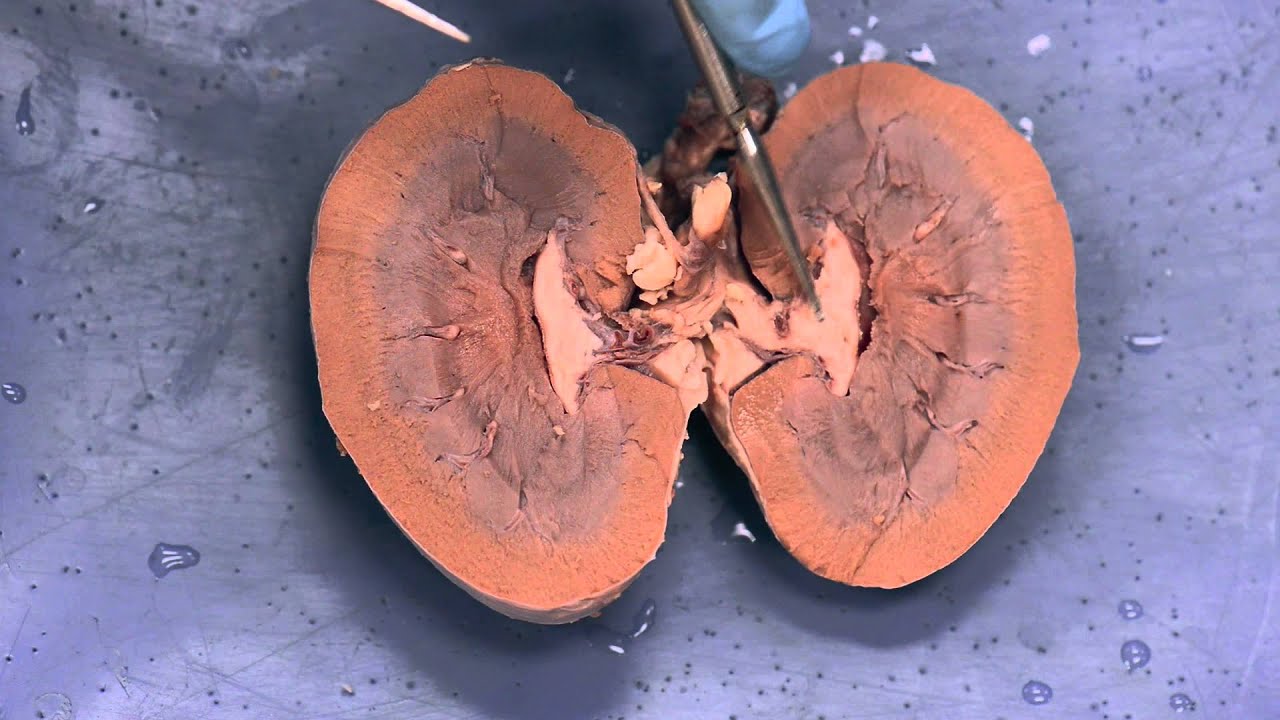 Sheep Kidney Dissection A&P II - YouTube
