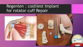 Regenten Bio Inductive Implant For Rotator Cuff Repair Costliest Implant For Rotator Cuff Repair.
