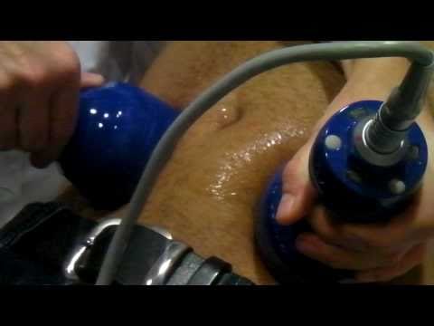 come distruggere la cellulite