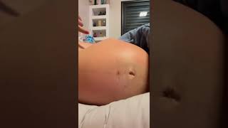 Bebê Mexendo Na Barriga Da Mamãe