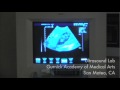 Ultrasound Technology Career.mov