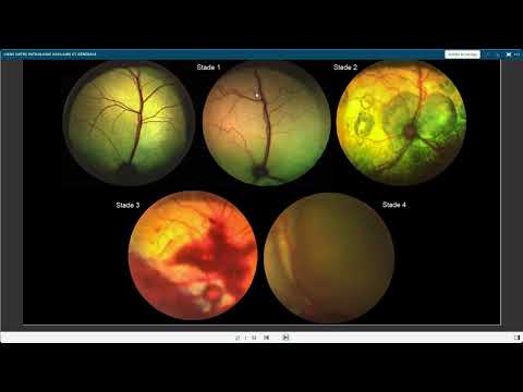 Liens entre pathologie oculaire et générale Wizzvet