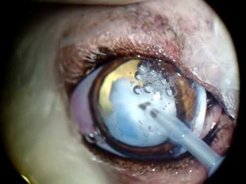 accommodating intraocular lens.  by foldable acrylic intraocular lens implant in a 10 year-old poodle.