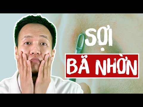CHUYÊN GIA Tiết lộ 6 ĐIỀU quan trọng về SỢI BÃ NHỜN TIPS Cách Trị mụn tại nhà | Dr Hiếu