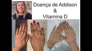 Dra. Laís - Doença de Addison