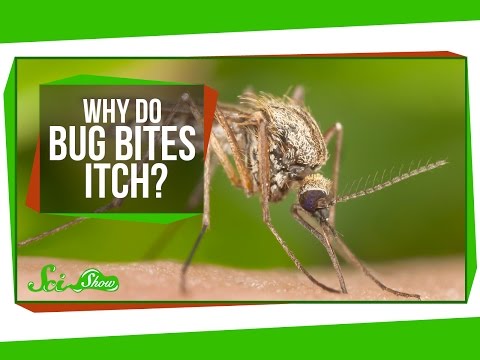 Why Do Bug Bites Itch? Why Do Bug Bites Itch? klip izle