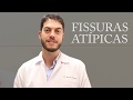 O que é fissura anal atípica? | Dr. Marcelo Werneck