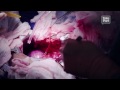 The Chain | The Surgery (3 of 5) | TakePart TV