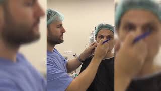 Kök Hüceyrə Əməliyyatı Lipofillinq - Dr. Vugar Alakbarov