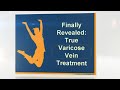 Finally Revealed True Varicose Vein Treatment