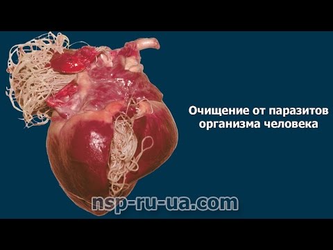 очищение от паразитов в домашних условиях содой очищение от паразитов в домашних условиях содой