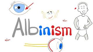 Albinism - Why Does It Happen?