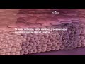 Solución Roche para la prevención de Cáncer Cervical