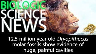 Science News - 12.5 million year old Dryopithecus molar fossils show evidence of painful cavities