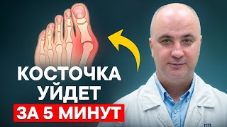 Как Уменьшить Косточку На Ноге Без Операции? Лучшие Методики И Упражнения