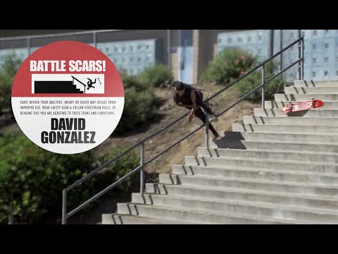 The Worst Injuries Of David Gonzalez’s Career | Battle Scars