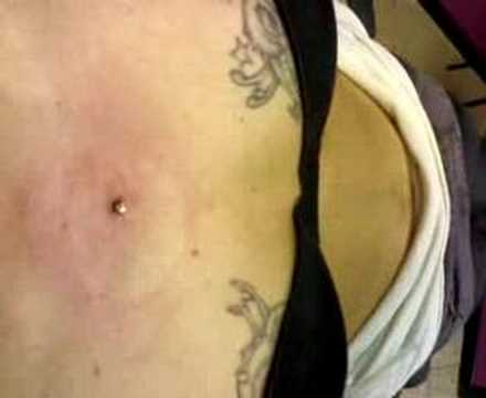 Pose de piercing Epidermique Pose de piercing Epidermique