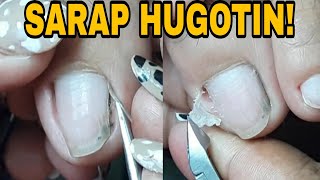 Removing Dry Skiningrownpedicure 22 Ozamiz Manicurista