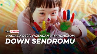 Hastalık değil fazladan bir kromozom: Down sendromu