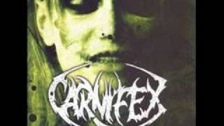 Watch Carnifex Aortic Dissection video