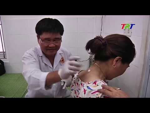 Bệnh đau vai gáy nguyên nhân và cách điều trị