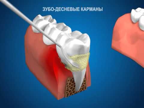 Как сделать розы из ленты для топиария Как сделать розы из ленты для топиария