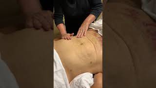 Post Lipo Mldmanual Lymphatic Drainage