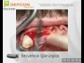cirugía dental