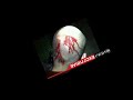 GEORGE ZIMMERMAN head injury photo is FAKE !!! PHOTOSHOP blood image taking from another picture!!!!