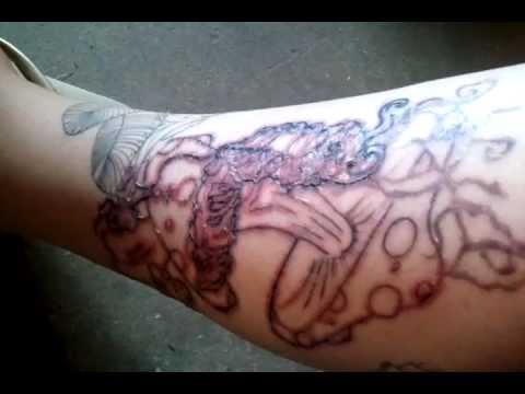 Infected tattoo