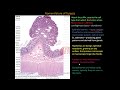 112P - Nomenclature of benign and malignant cancers, How to name cancers, mixed tumors explained