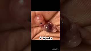 Pregnancy Journey